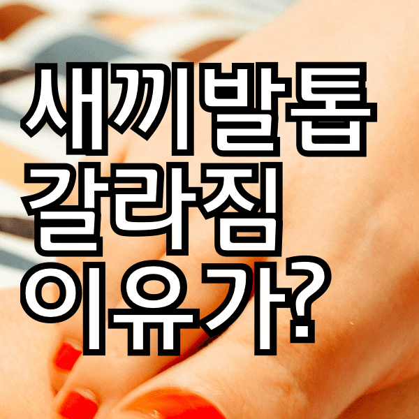 새끼 발톱 갈라짐 생기는 원인과 해결법 알아봐욤