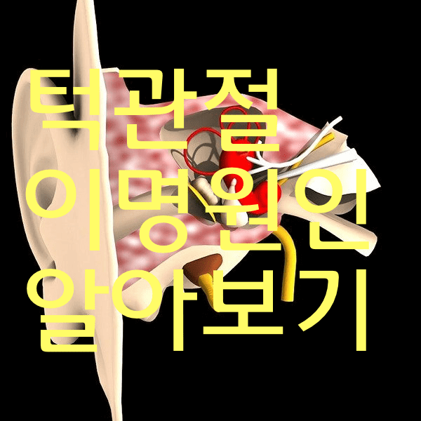 턱관절 장애 , 이명원인 일까? 귀에서 나는소리가 궁금한가욤?
