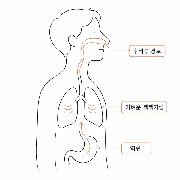 후비루와 폐 쌕쌕거림, 위식도역류가 목 간질거림으로 이어지는 위치 설명 그림