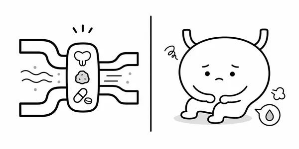 요도가 막힌 경우와 방광 수축력이 약한 경우를 비교한 단순한 설명 그림